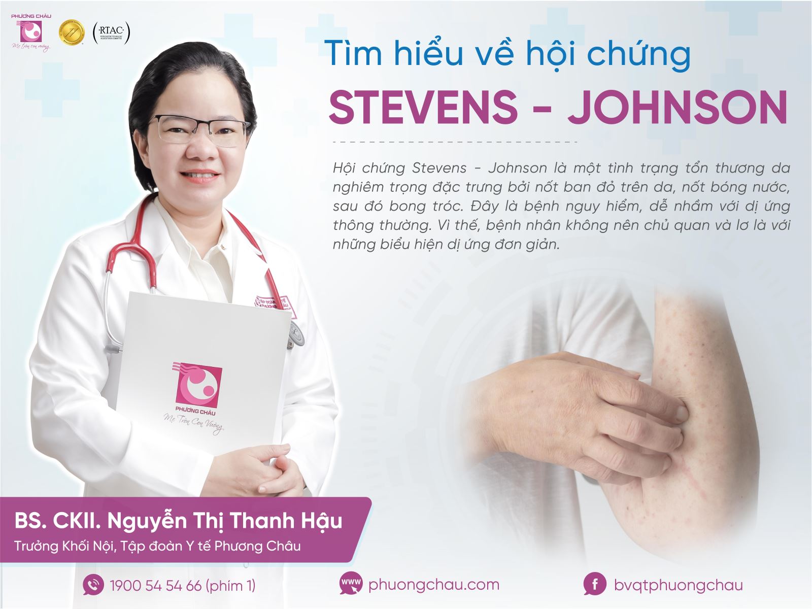 Hội chứng Stevens-Johnson rất dễ nhầm lẫn với những biểu hiện dị ứng đơn giản