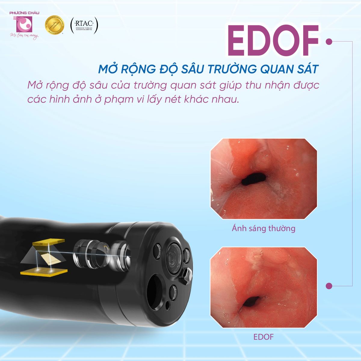 Công nghệ EDOF trên máy nội soi Olympus X1