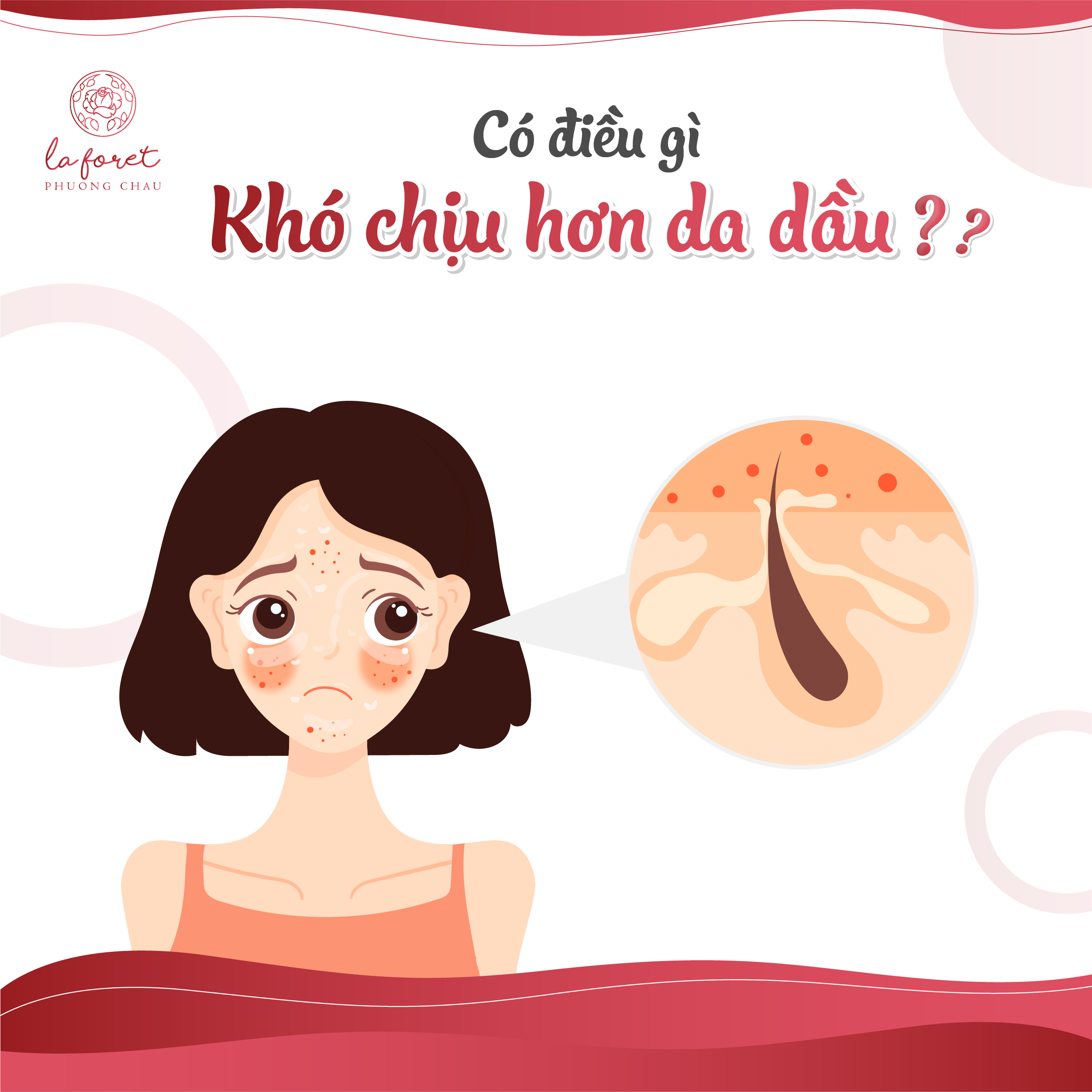 chăm sóc da, da dầu, làm đẹp, La Foret, Phương Châu, hotline