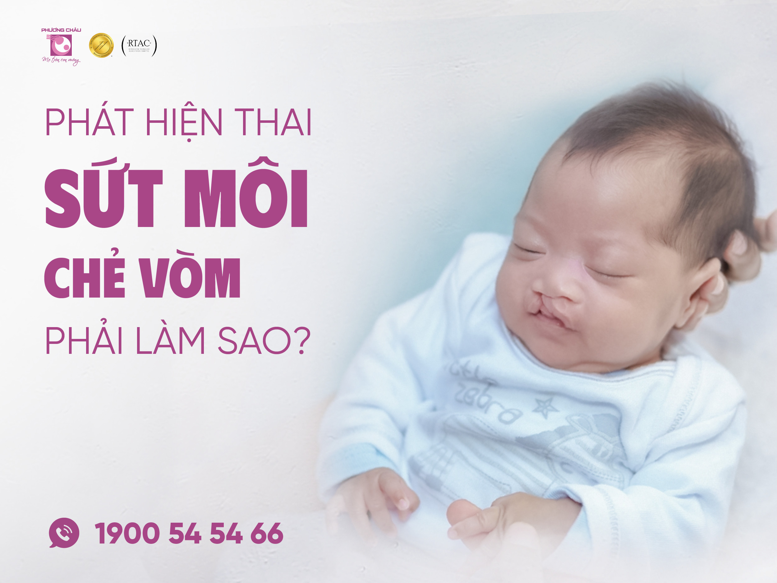 phát hiện, thai, sứt môi, chẻ vòm, phải làm sao, sản khoa, phương châu