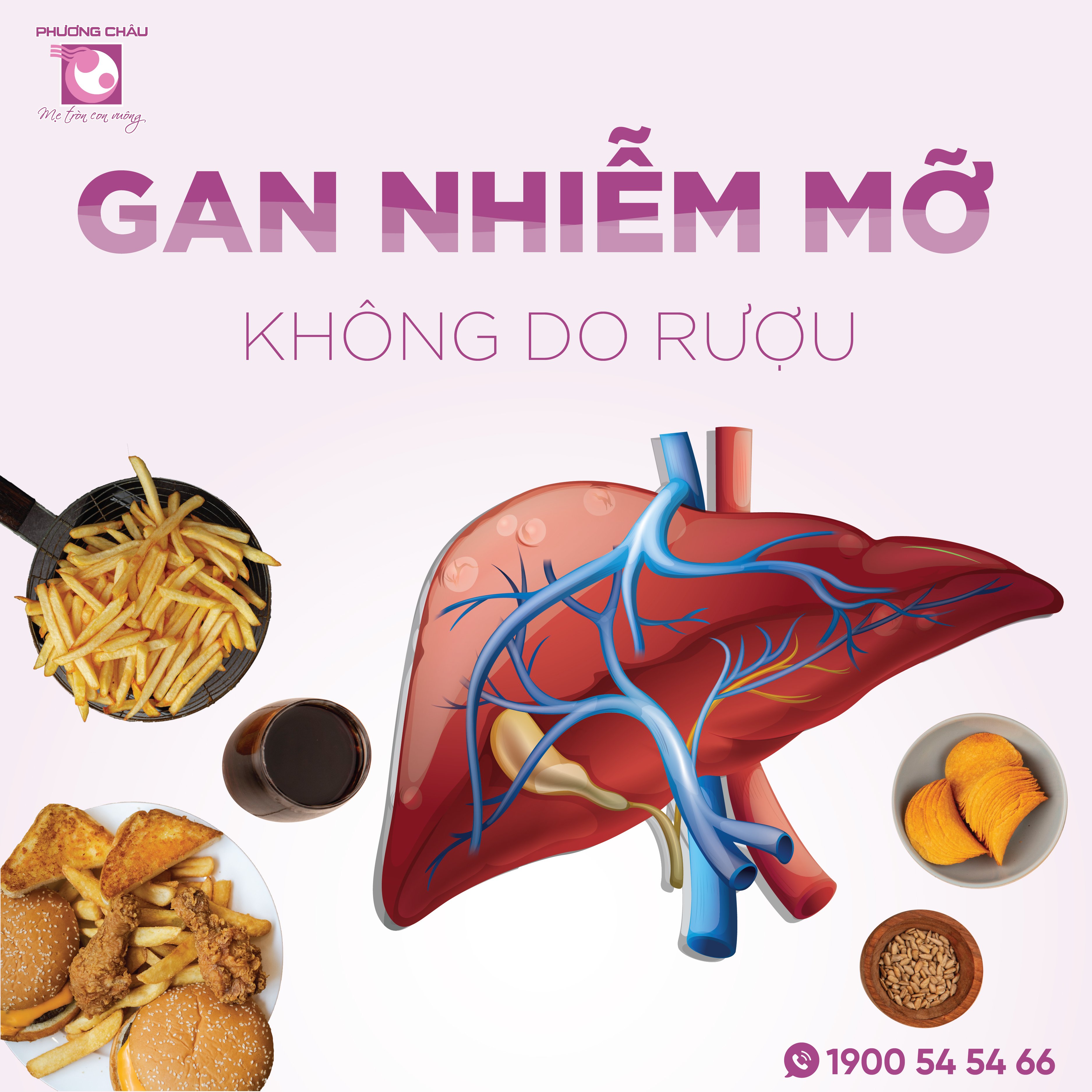 gan nhiễm mỡ không do rượu, có nguy hiểm không, đối tượng nguy cơ, triệu chứng, cách điều trị, đa khoa phương châu, cần thơ