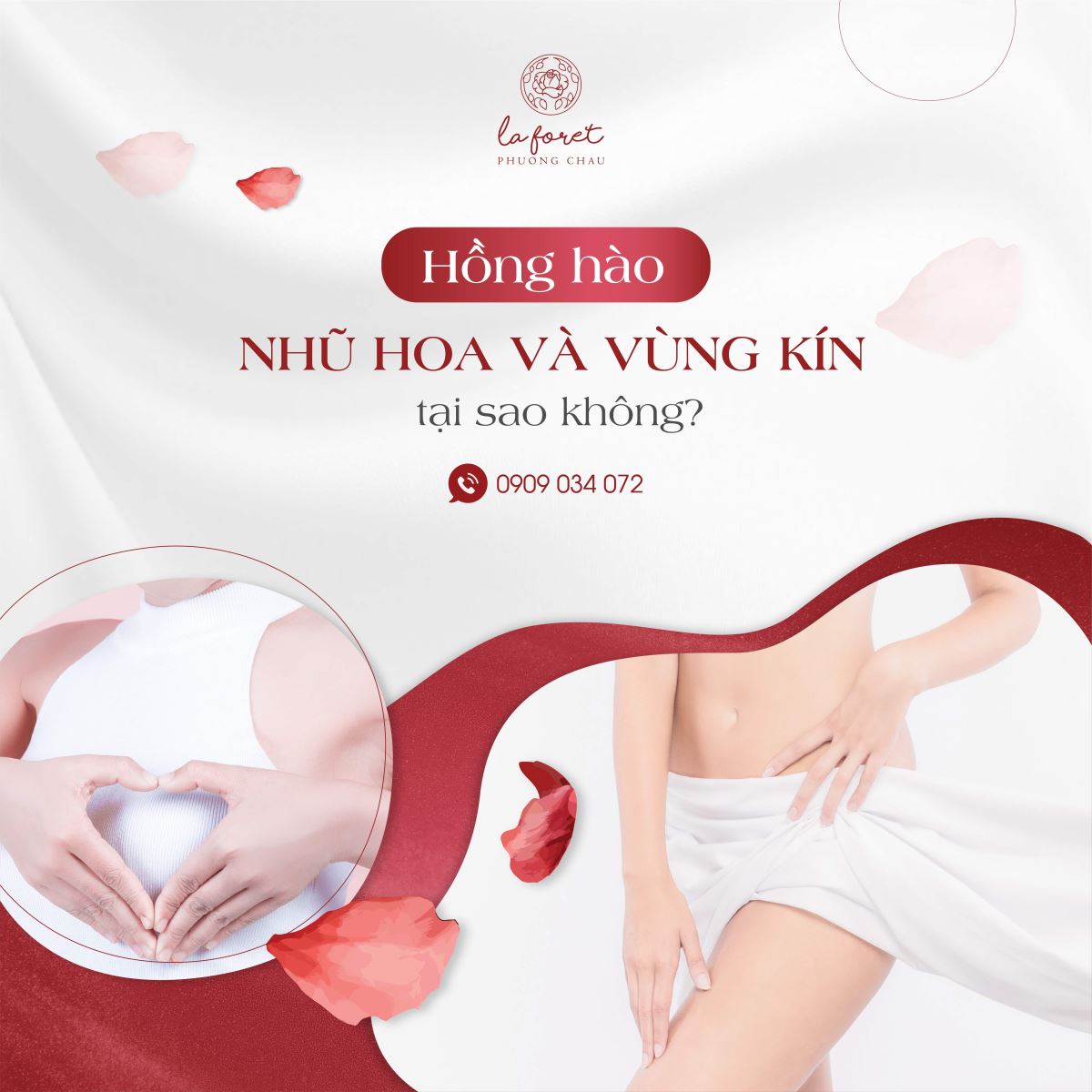 hồng hào, nhũ hoa, vùng kín, bikini, làm đẹp, La Foret, Phương Châu