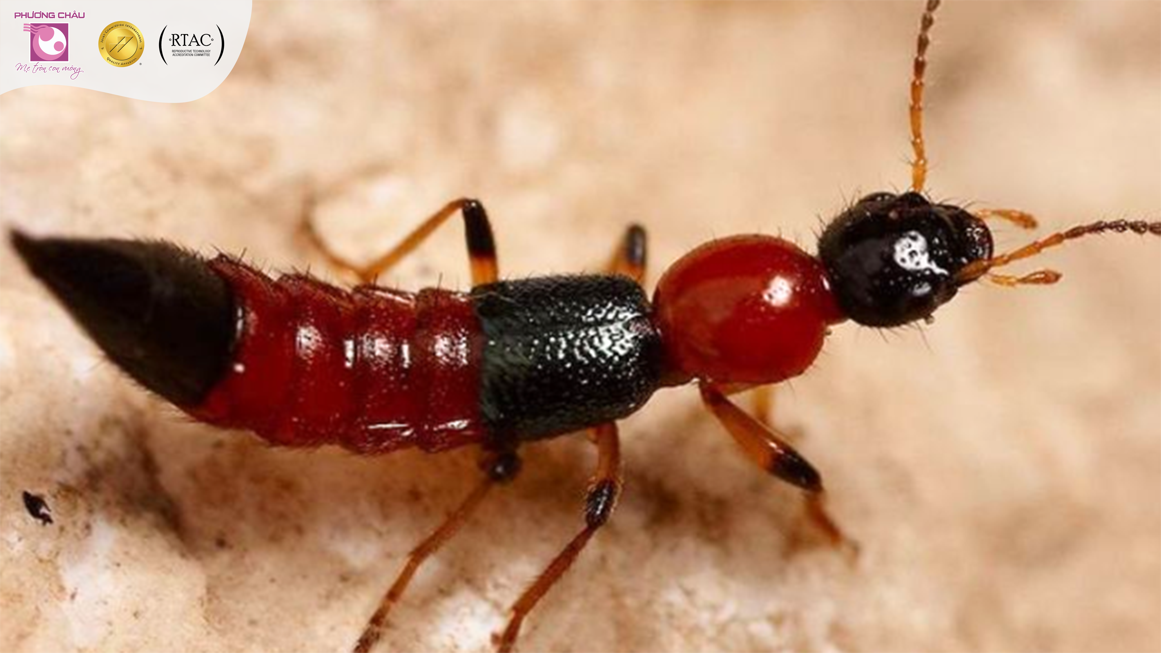  Với độc tính Pederin mạnh gấp 12 lần nọc rắn hổ mang, nhiều người lo sợ khi vô tình tiếp xúc với loài kiến này.