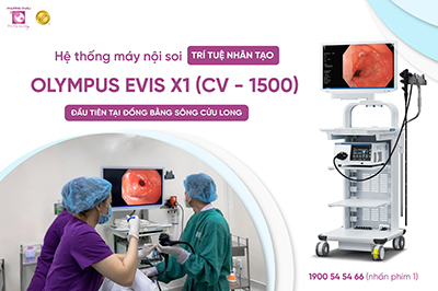 nội soi cần thơ, may noi soi, evis x1 cv1500, olympus evis x1 cv1500, trí tuệ nhân tạo, máy nội soi có trí tuệ nhân tạo, noi soi tieu hoa can tho, da khoa phuong chau, nội soi tiêu hóa, noi soi, nội soi, đa khoa phương châu, nội soi tiêu hóa không đau, nội soi cần thơ