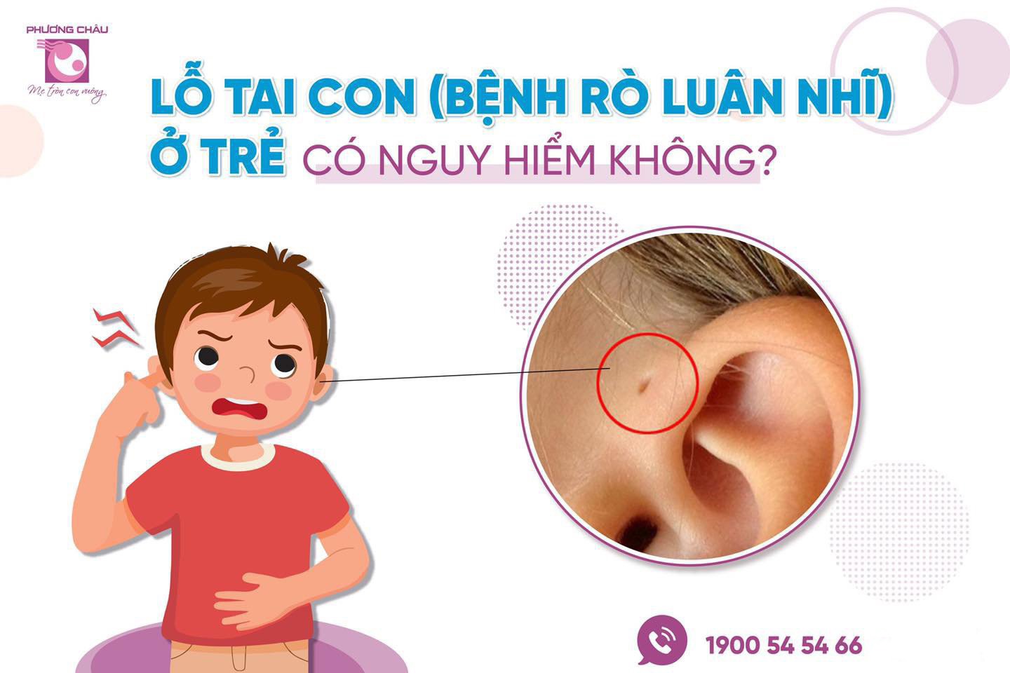 lỗ tai, tai, mũi, họng, chuyên khoa, chuyên sâu, rò luân nhỉ, triệu chứng, điều trị, Nhi khoa, Phương Châu