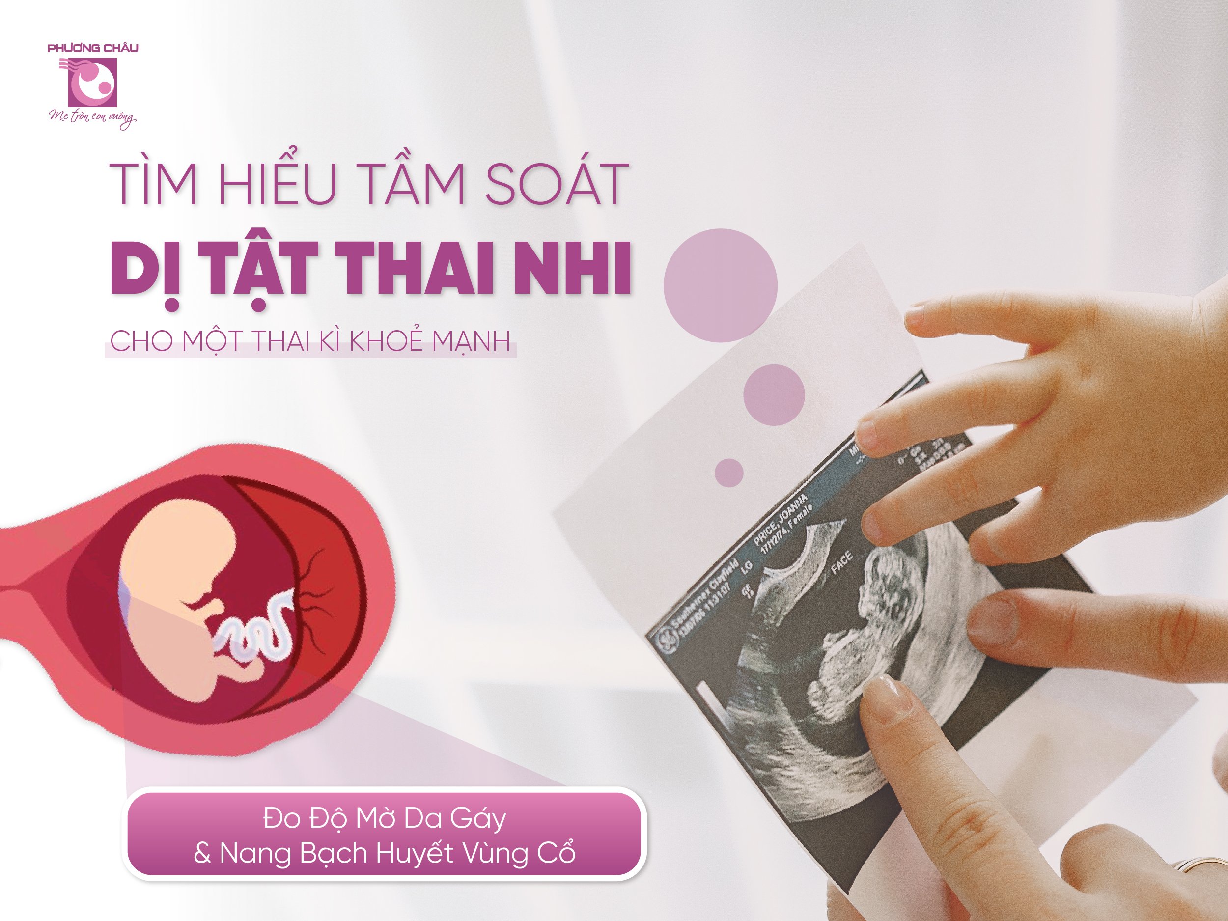 tầm soát. dị tật, thai nhi, khảo sát, độ, mờ, da, gáy, nang, bạch huyết, vùng, cổ